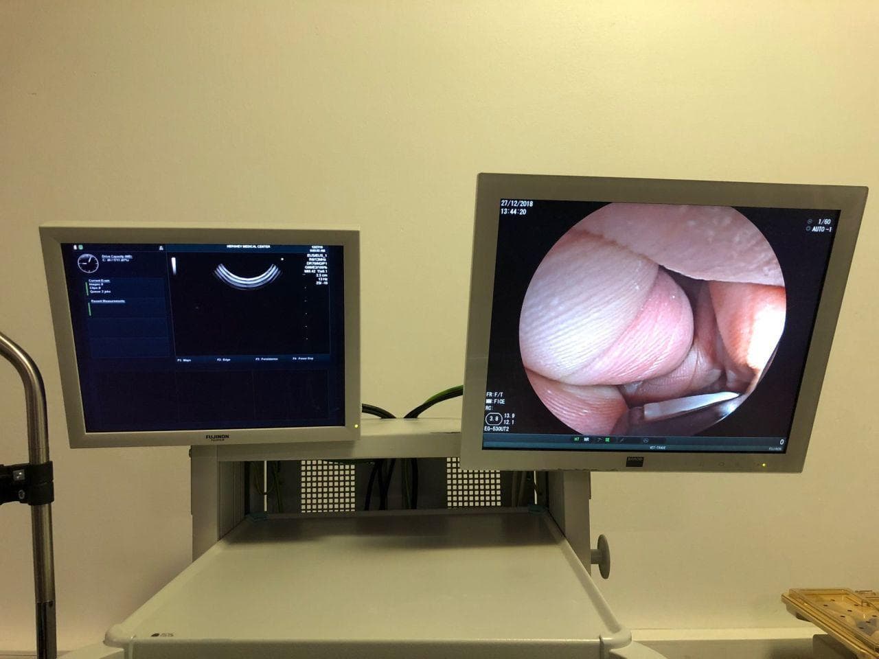 FUJIFILM EG-530UT2 Ultrasound Video Gastroscope for EUS Procedures thumbnail 5