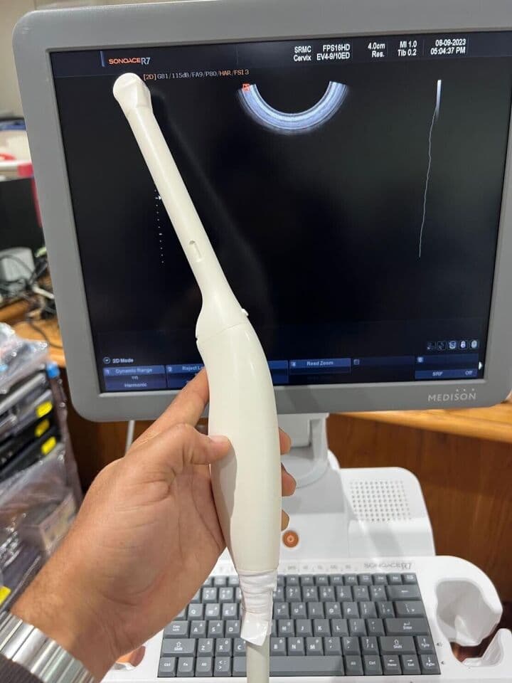 Samsung SonoAce 3D/4D OB/GYN Ultrasound System thumbnail 5