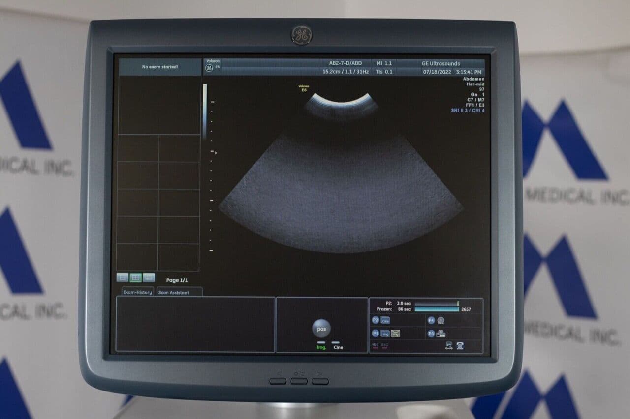 GE AB2-7-D Convex Array Ultrasound Transducer thumbnail 2