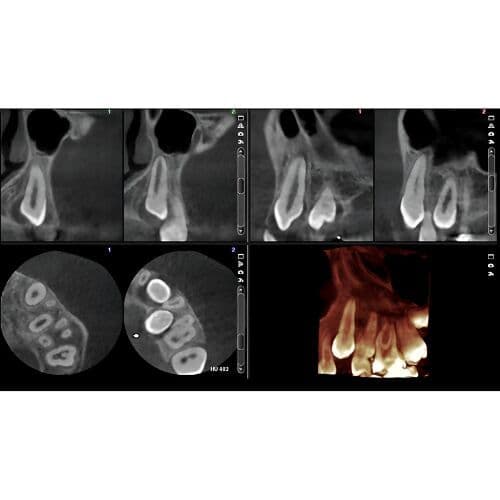 Planmeca Pan + CBCT (8x8 FOV) 3D Dental X-Ray System thumbnail 7