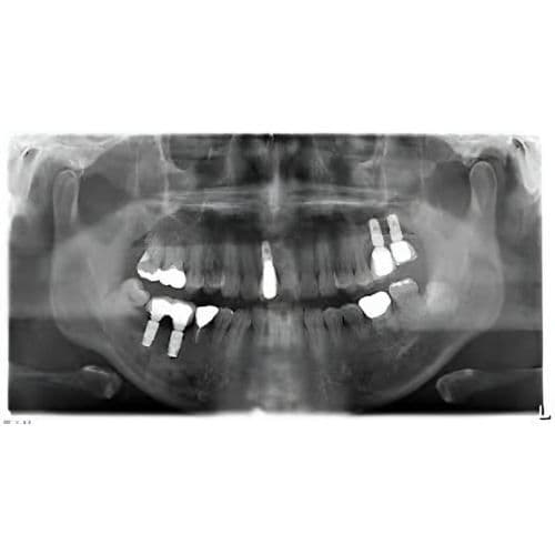 Sirona Orthophos XG Pan + Ceph Dental X-Ray System thumbnail 2