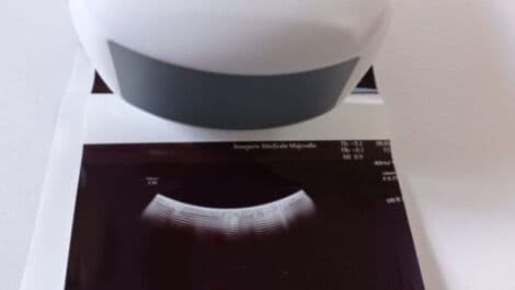 GE EM6C 4D Convex Matrix Ultrasound Transducer thumbnail 6