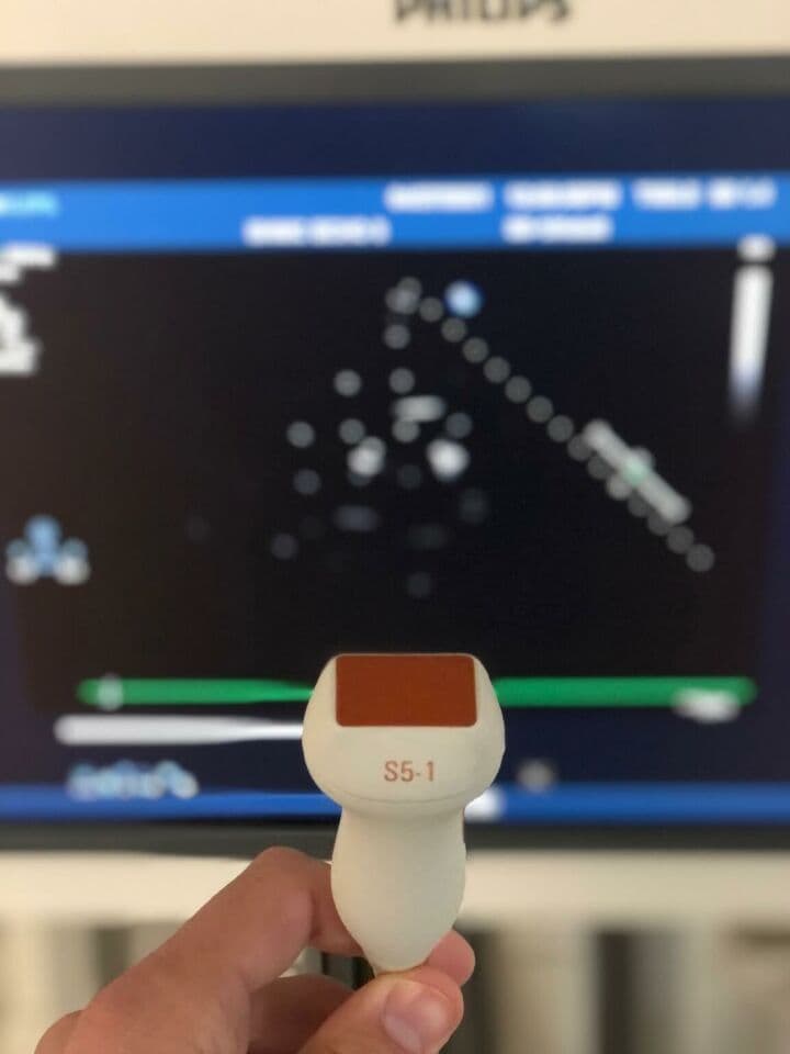 Philips iE33 Diagnostic Ultrasound System thumbnail 7