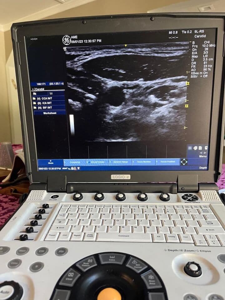 GE 9L-RS Linear Array Ultrasound Transducer for Vascular and Small Parts Imaging thumbnail 2