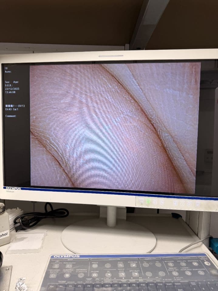 For Sale OLYMPUS WA50024B Laparoscope thumbnail 2