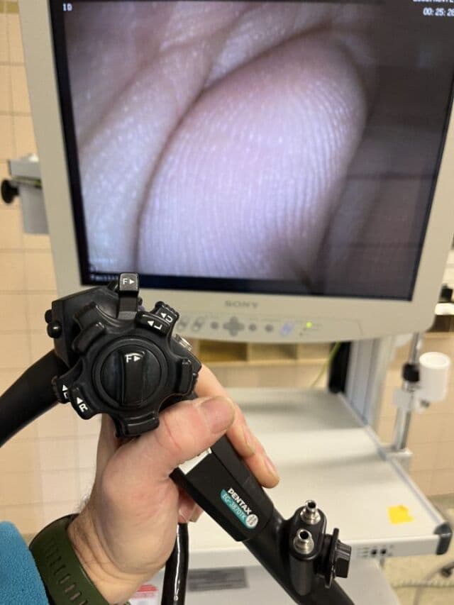 Pentax EG-3870TK | HD Gastroscope | Upper Endoscope Video Scope | P/N EG-3870TK | Extra-Large 3.8mm Therapeutic Channel | Pentax EPK-i Parts