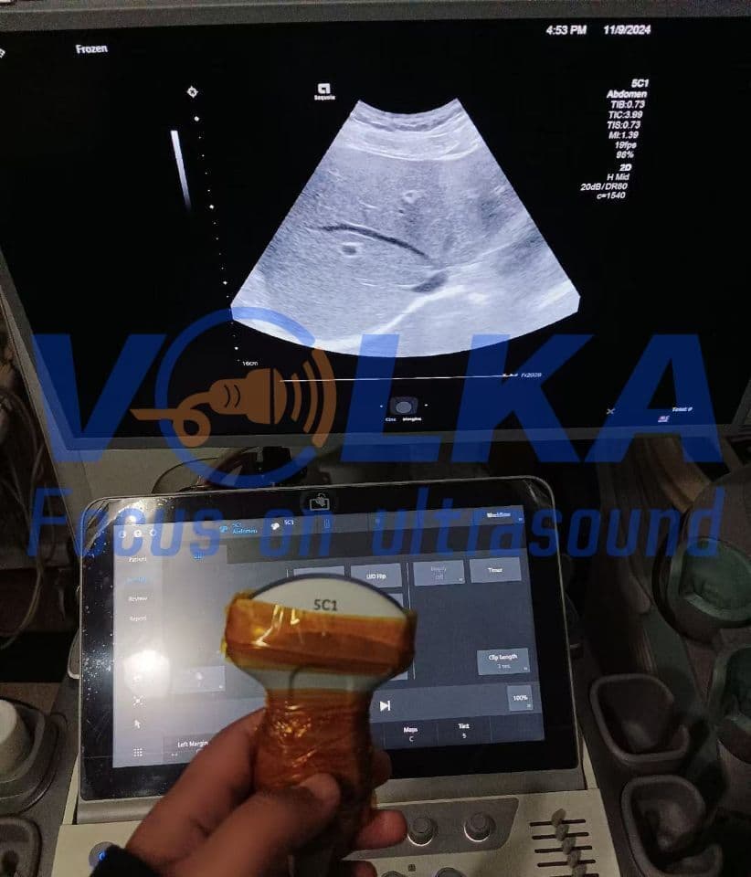 Siemens Acuson 5C1 Convex Ultrasound Transducer