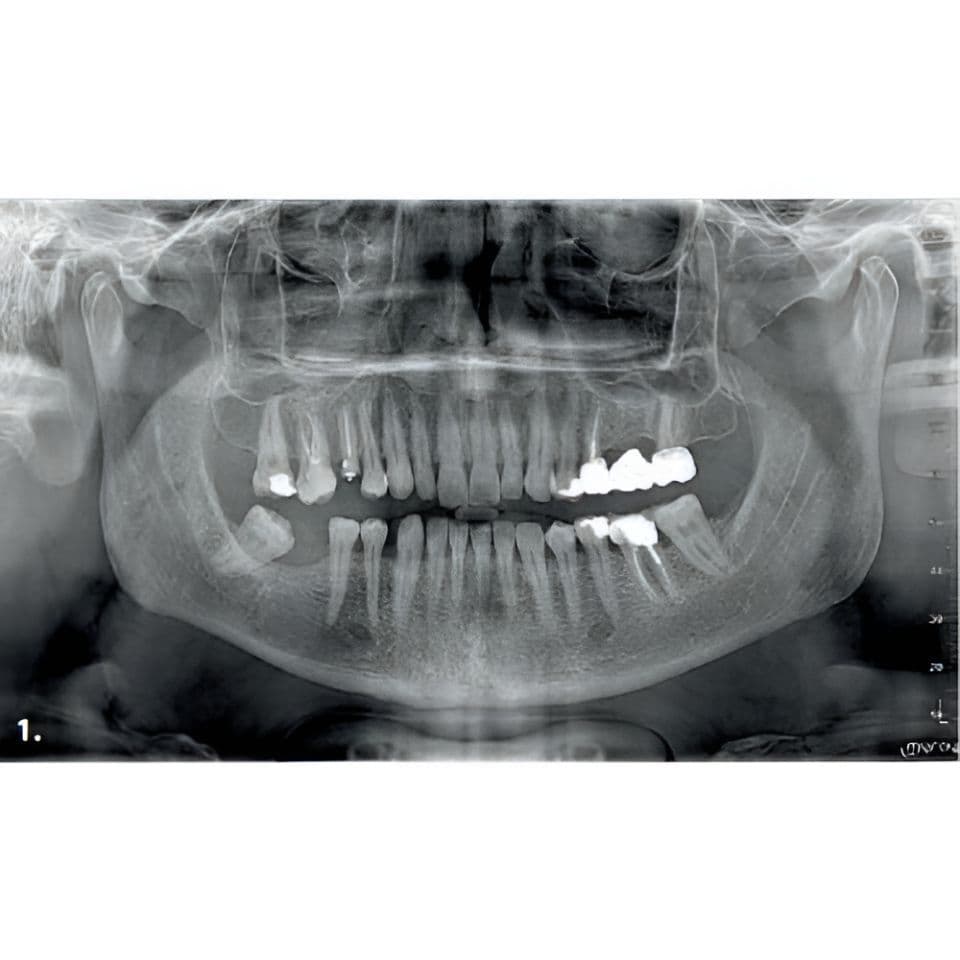 MyRay Hyperion X9 PRO Pan/Ceph/CBCT Dental X-Ray with 13x16 FOV thumbnail 6