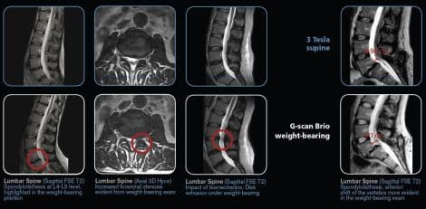 Weight-Bearing MRI Scanner — Esaote G-Scan thumbnail 7