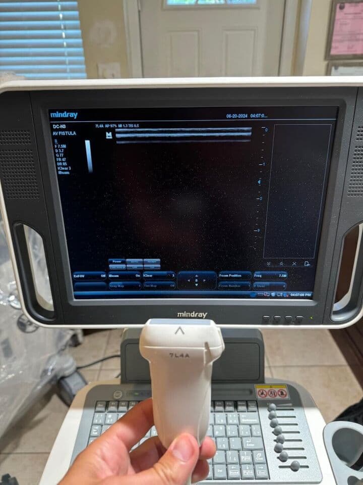 Mindray DC-N3 OB/GYN & Vascular Diagnostic Ultrasound System thumbnail 2