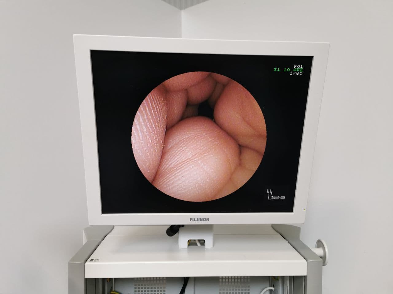 Complete Endoscopy Tower by Fujinon — EPX-4400 / PB-20 thumbnail 8