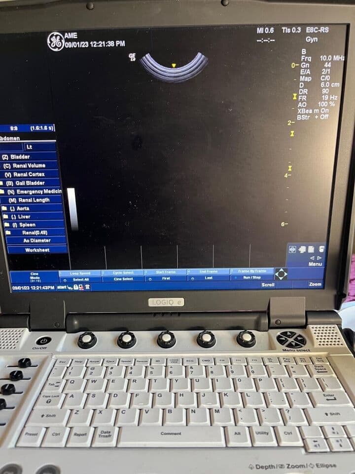 GE E8C-RS Endocavitary Ultrasound Transducer thumbnail 2