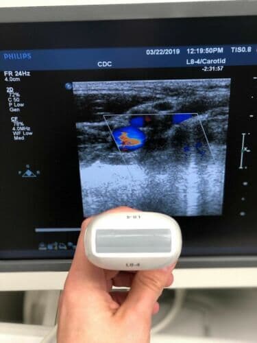 Philips L8-4 Linear Ultrasound Transducer Probe thumbnail 3