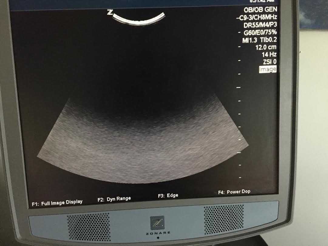 ZONARE C9-3 Convex Array Ultrasound Transducer Probe thumbnail 2