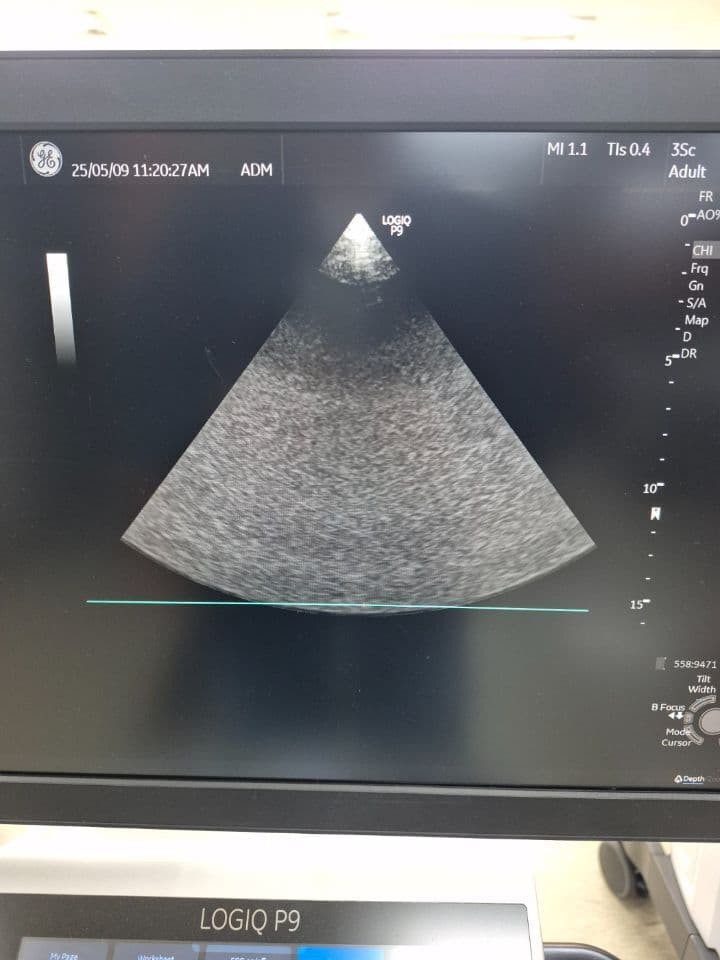 GE 3Sc-RS Cardiac Sector Ultrasound Transducer thumbnail 4