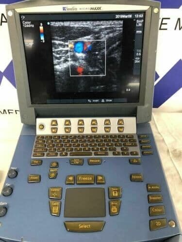 Sonosite Micromaxx Portable Ultrasound System with L38e Linear Array Vascular Probe thumbnail 2