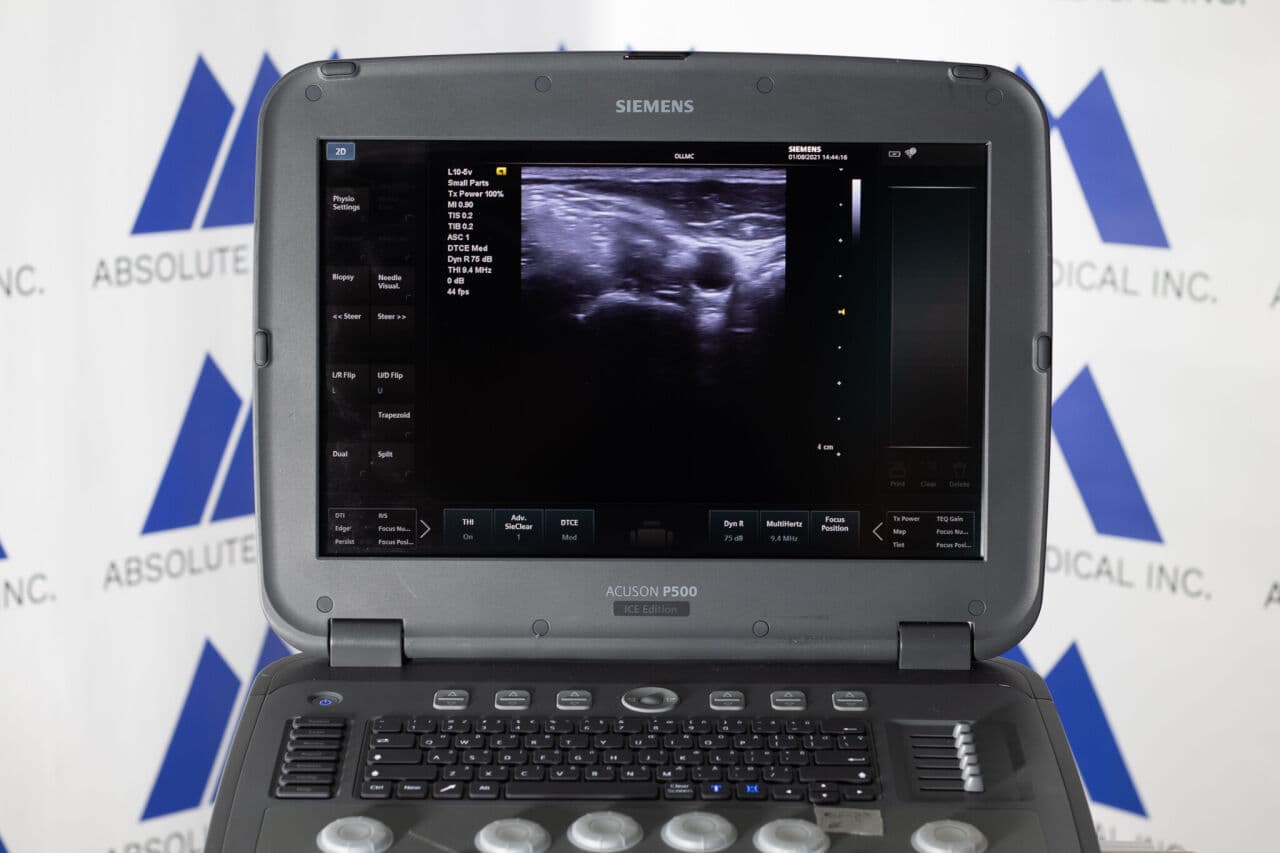 Siemens Acuson P500 Frosk Portable Ultrasound System thumbnail 4