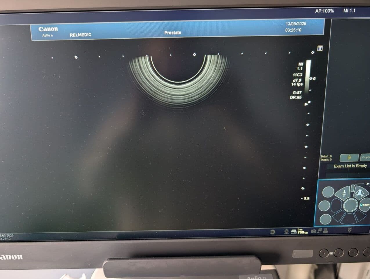 Toshiba Aplio A Diagnostic Ultrasound System thumbnail 12