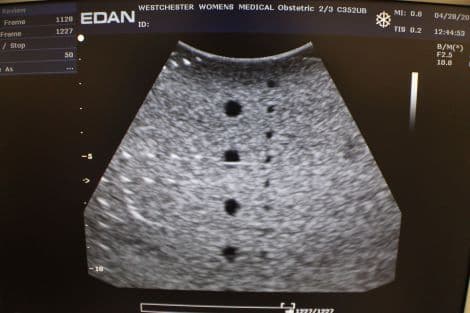 Edan C352UB Convex Array Ultrasound Transducer for U50 Systems thumbnail 3