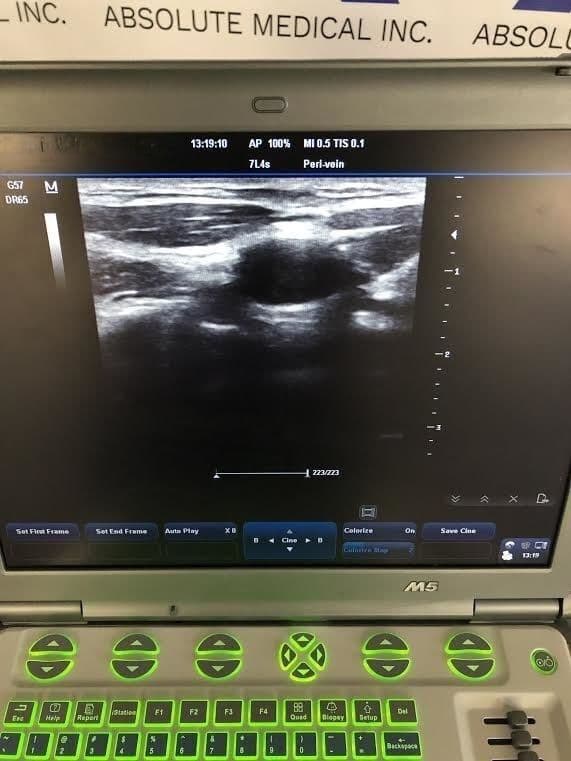Mindray M5 Portable Ultrasound System thumbnail 7