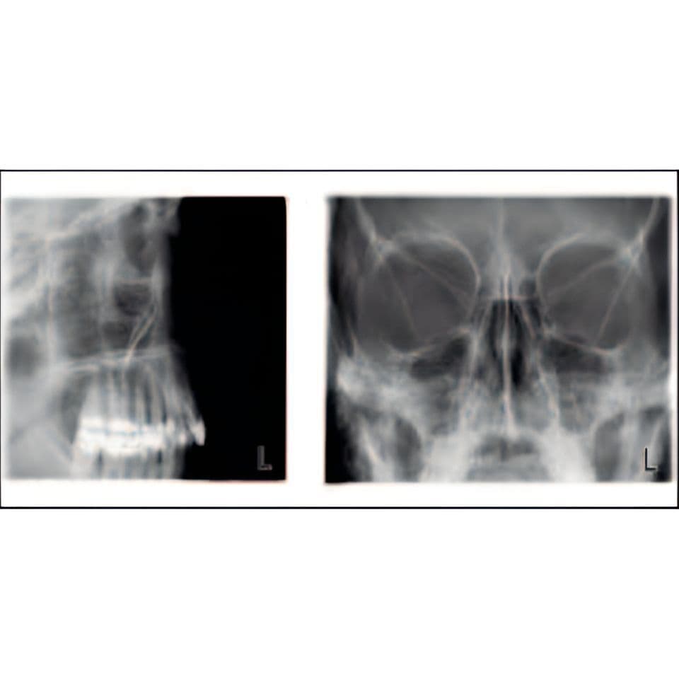 Planmeca ProMax Pan Dental X-Ray System thumbnail 7