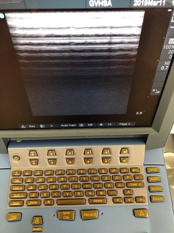 Sonosite L25e Linear Ultrasound Transducer Probe thumbnail 5