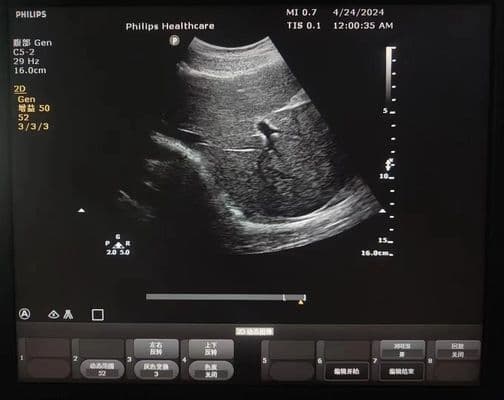 Philips C5-2 Convex Array Ultrasound Probe thumbnail 2