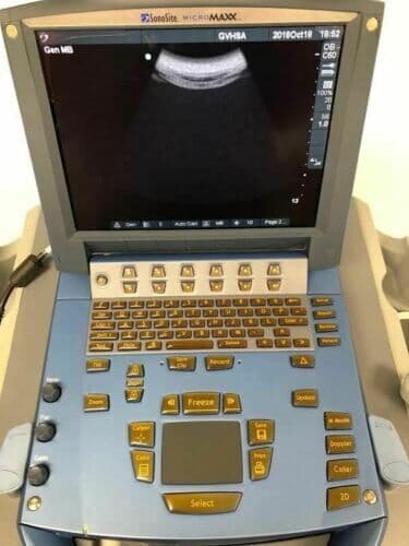 Sonosite C60e Convex Ultrasound Transducer Probe thumbnail 4