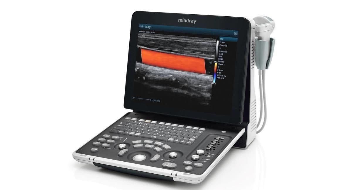 Mindray Z60 Portable Color Doppler Ultrasound System