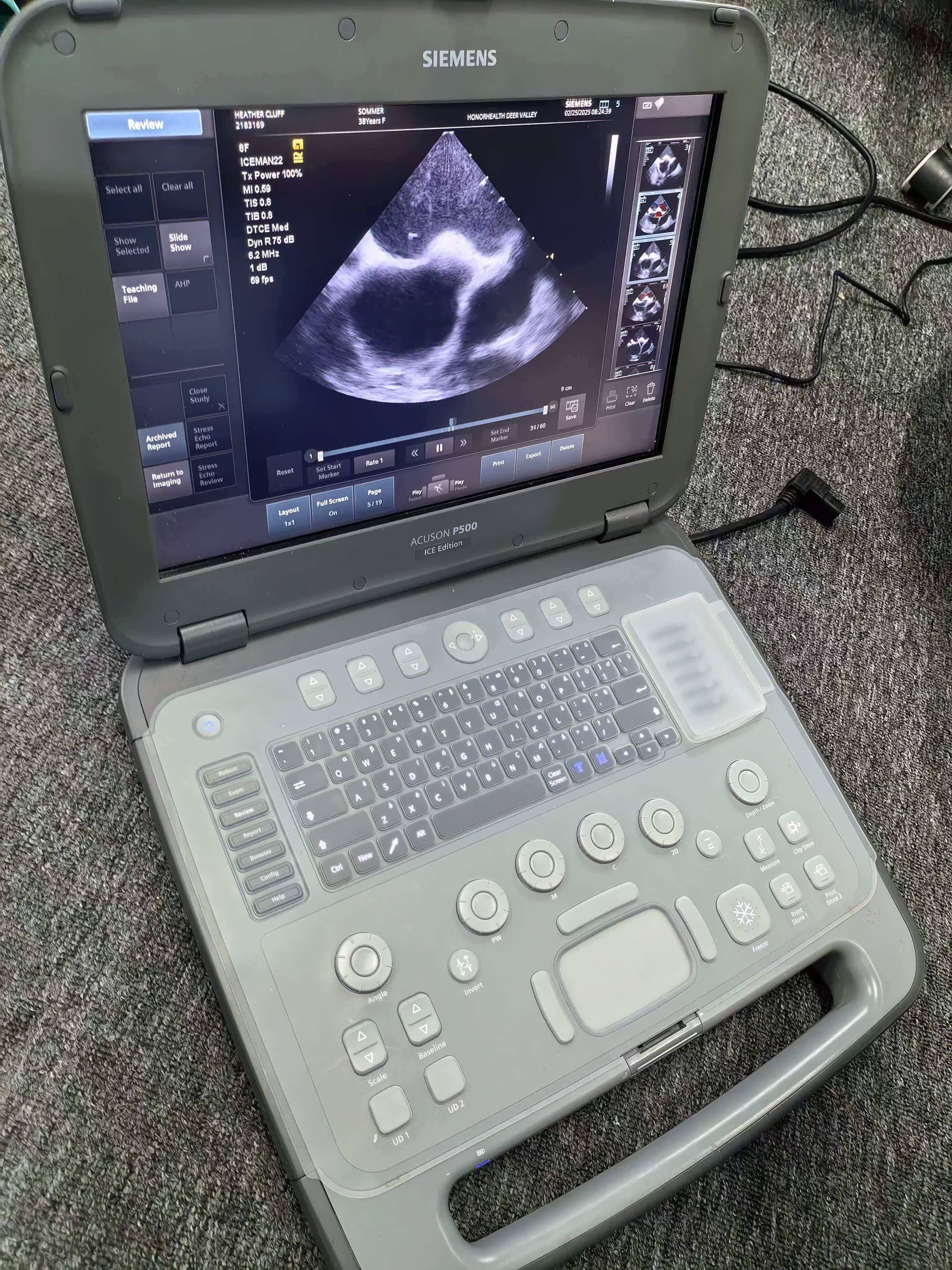 Siemens P500 | ACUSON P500 Ultrasound | 2019 YOM Used Portable Color Doppler | Siemens Laptop Ultrasound Without Probes | Point-of-Care Emergency Scanner Gantry