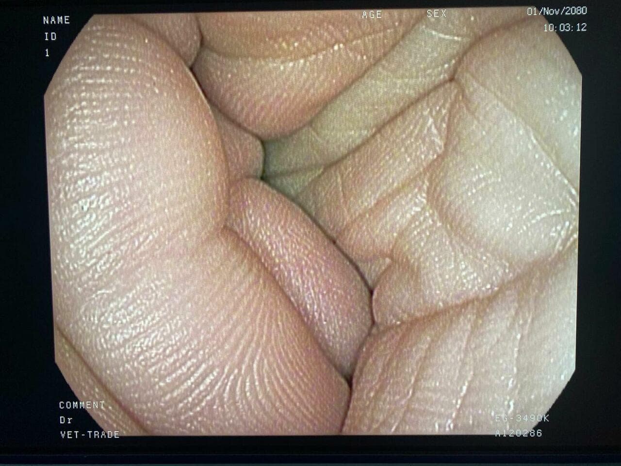 PENTAX EG-3490K Video Gastroscope for Diagnostic and Therapeutic Use thumbnail 4