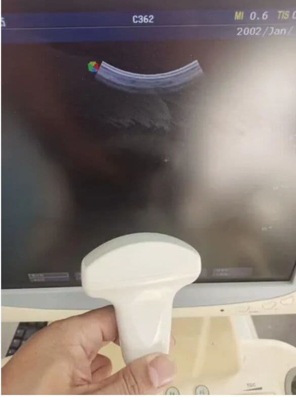 Sonoscape C362 Convex Ultrasound Transducer thumbnail 2