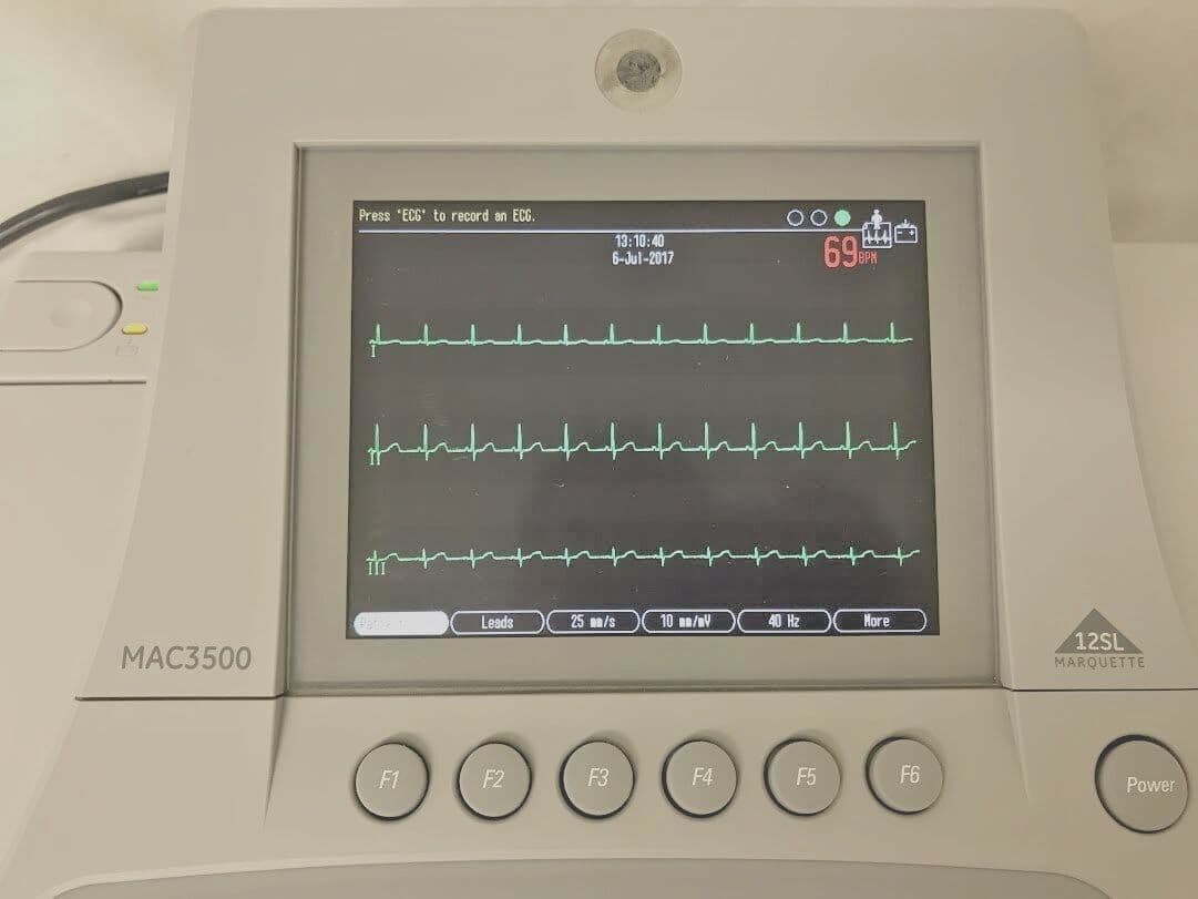 GE MAC 3500 Resting ECG System thumbnail 2