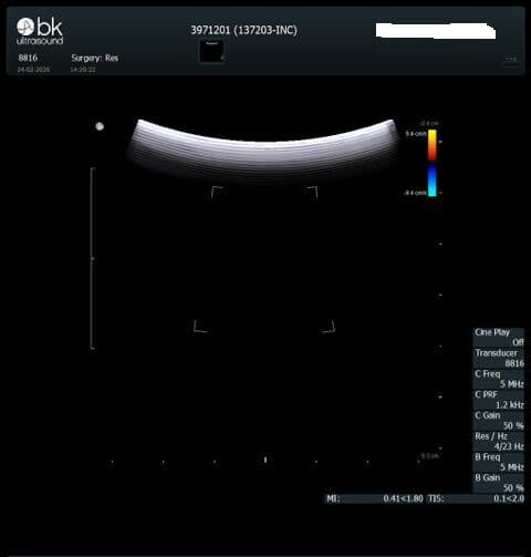 BK Medical 8816 T-Shaped Intraoperative Ultrasound Transducer thumbnail 5