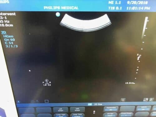 Philips C5-1 Convex Ultrasound Transducer Probe thumbnail 3