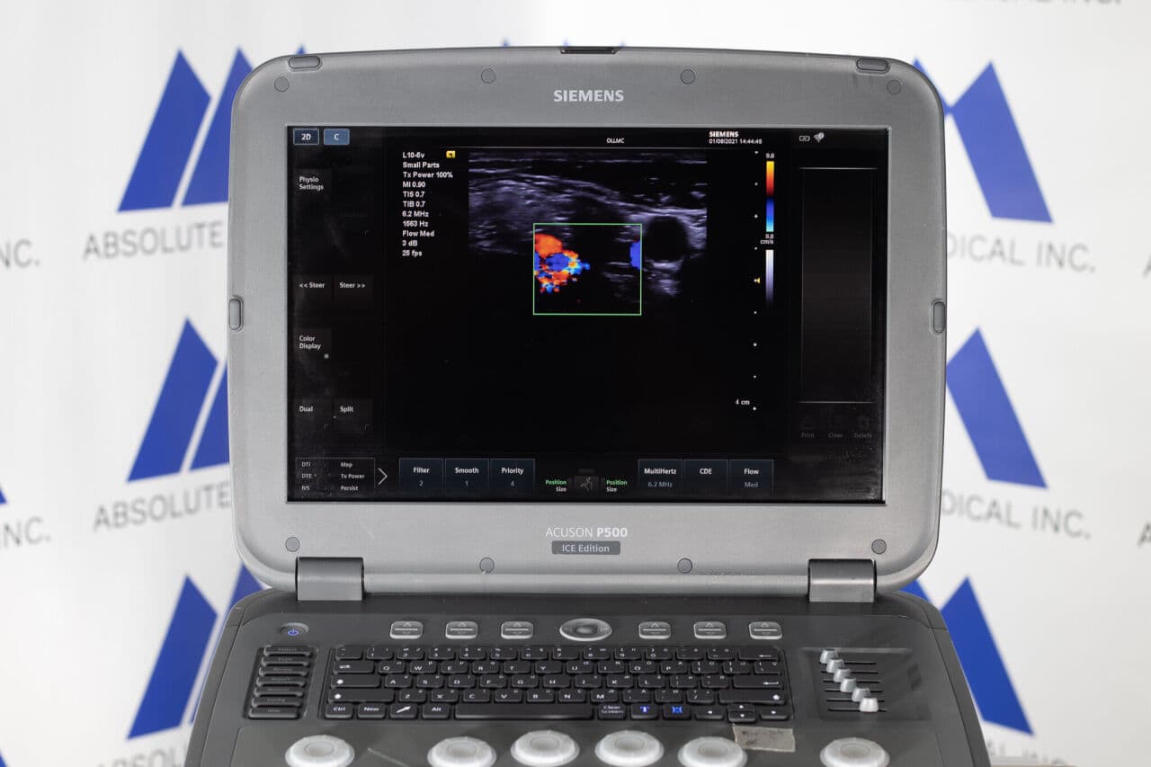 Siemens Acuson P500 Frosk Portable Ultrasound System thumbnail 6