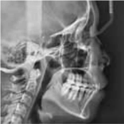 Vatech PaX-i Pan/Ceph Dental X-Ray System thumbnail 8