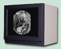 Medical Imaging Greyscale Display Monitor — FIMI MSD201H