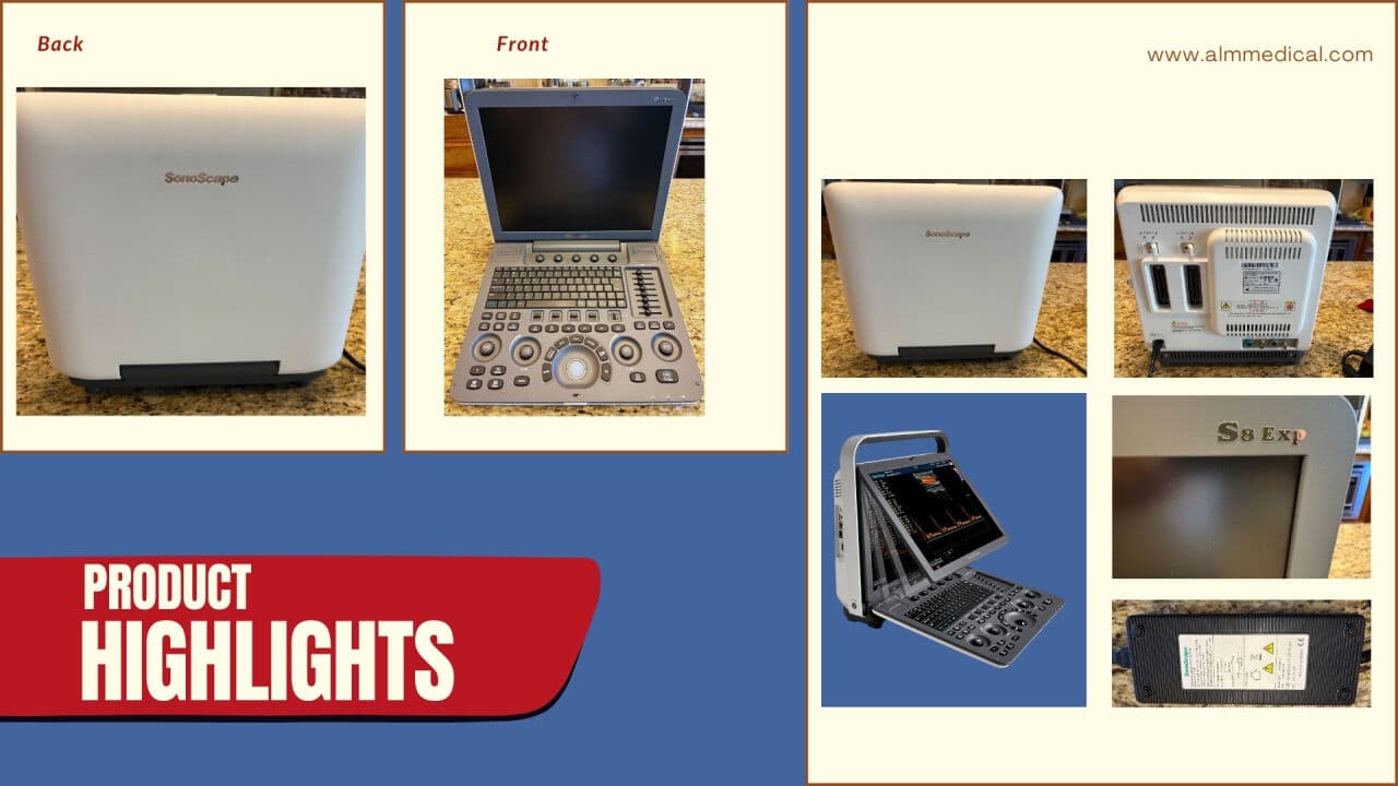 SonoScape S8 Portable Ultrasound System for Cardiac & Vascular Imaging thumbnail 4