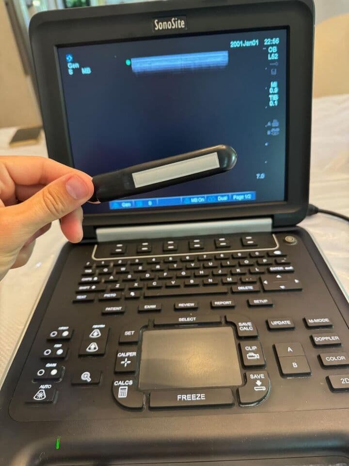 Sonosite Edge Veterinary Ultrasound System thumbnail 2