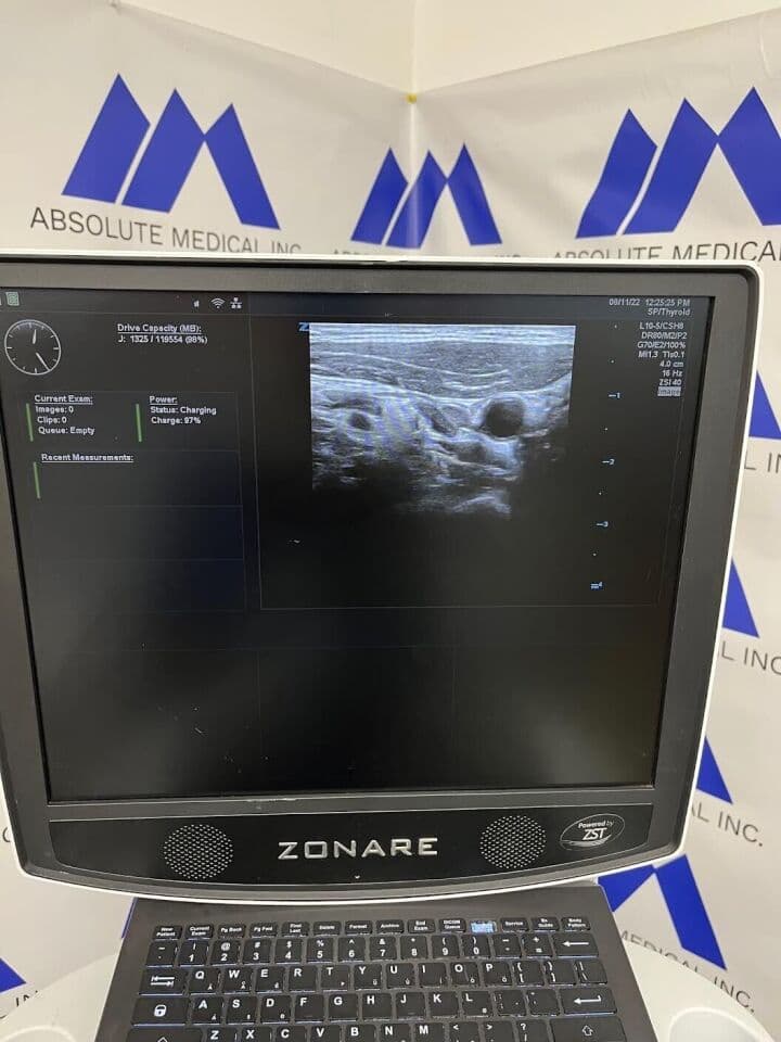 ZONARE ZS3 Cardiac Vascular Ultrasound System thumbnail 7