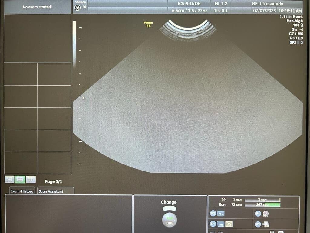 GE IC5-9-D Intracavitary Ultrasound Transducer thumbnail 4