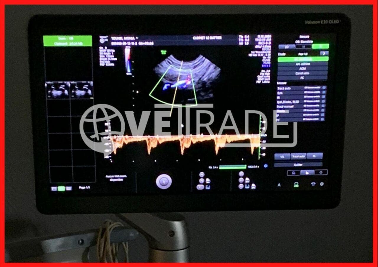 GE Voluson E10 Diagnostic Ultrasound System thumbnail 4