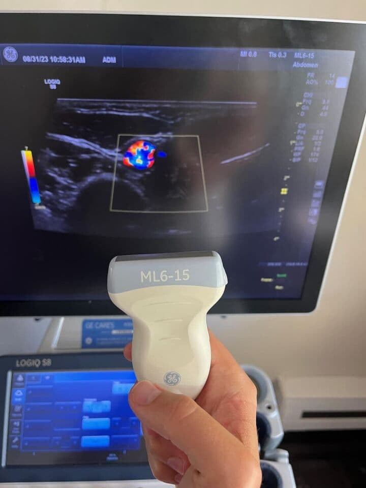 GE Logiq S8 XDclear Ultrasound System for Clinical Imaging thumbnail 4