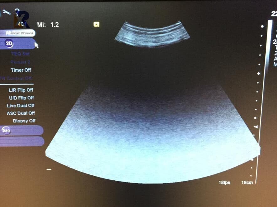Siemens 4C1 (S2000) Curved Array Ultrasound Transducer thumbnail 3