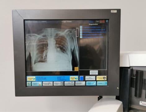 Kodak DirectView CR 975 Computed Radiography System thumbnail 4