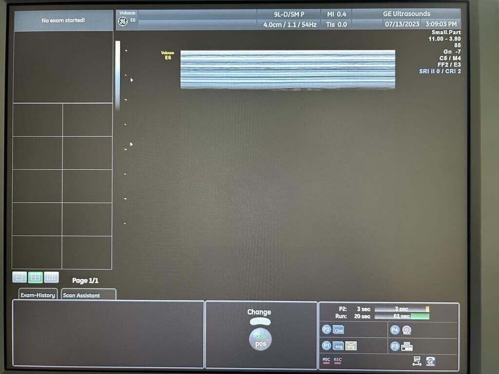 GE 9L-D Linear Ultrasound Transducer thumbnail 2