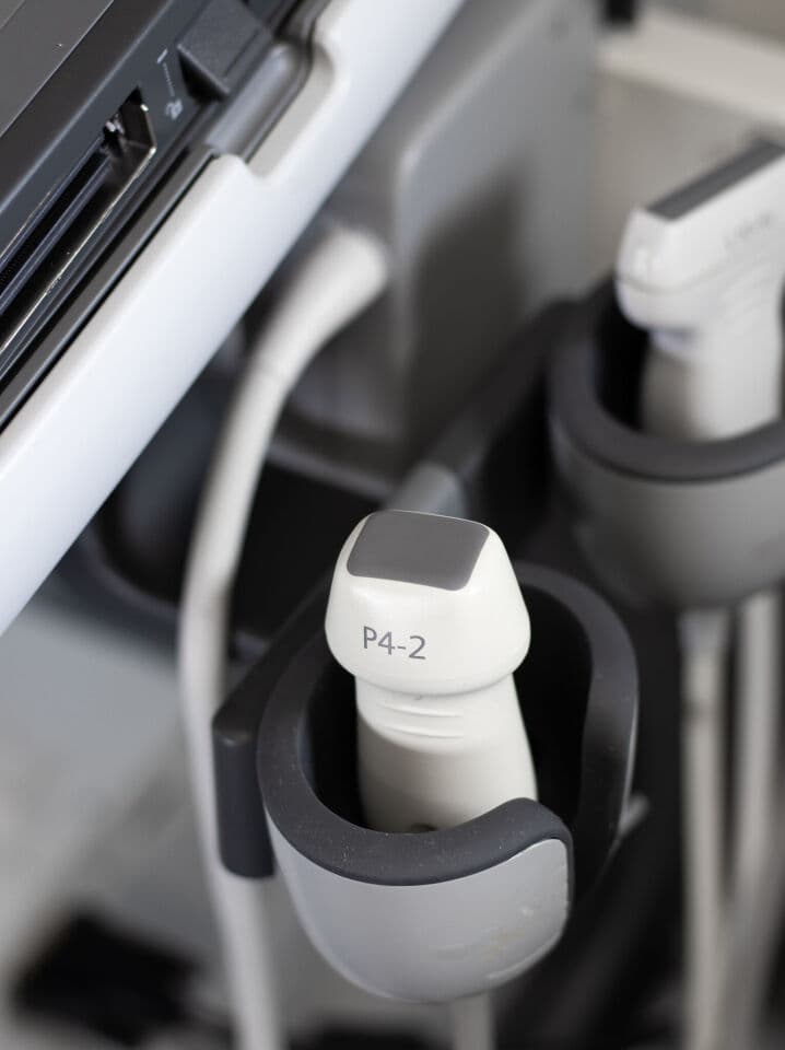 Siemens Acuson P500 Frosk Portable Ultrasound System thumbnail 10