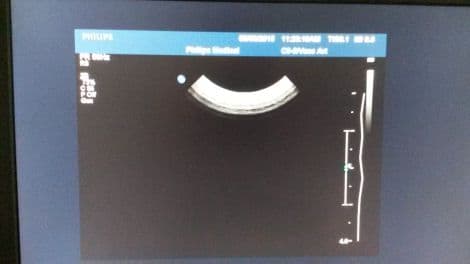 Philips C8-5 Curved Array Ultrasound Transducer for Neonatal Imaging thumbnail 3