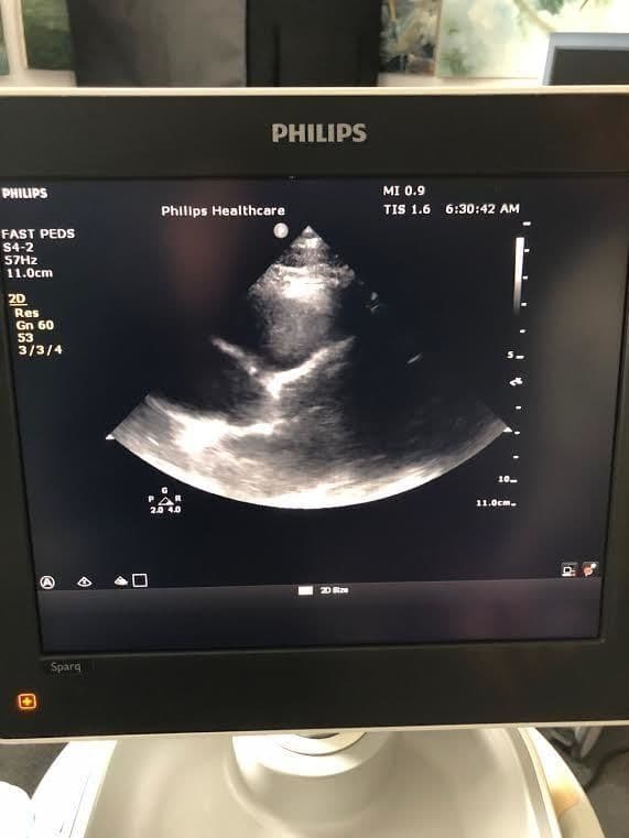 Philips S4-2 Phased Array Ultrasound Transducer thumbnail 3